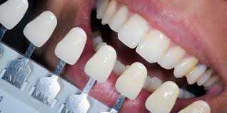Read more about the article Fixed Prosthodontics